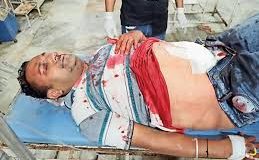 पुरानी अनाज मंडी की दुकान पर दिनदहाड़े वारदात, चावल कारोबारी के पुत्र को मारी गोलियां