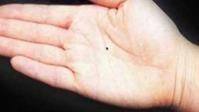 mole-palm-reading-_1-one_one-one_one-sixteen_nine